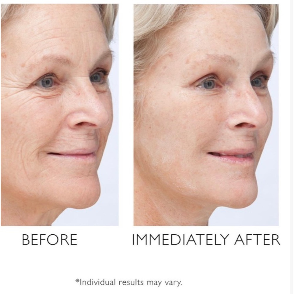 Set of 2 Peter Thomas Roth Instant Firmx Eye Serum Face Tightener Wrinkle Aging